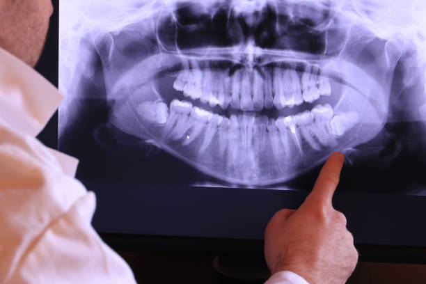 Best Emergency Treatment for Oral Infections in Raubsville, PA